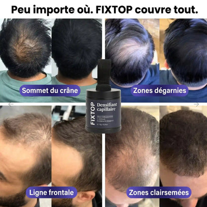 FIXTOP™